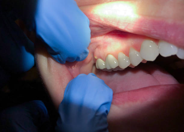 Best Emergency Pediatric Dental Care in Assumption, IL