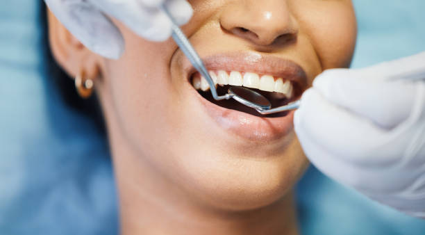 Best Emergency Care for Gum Disease in Assumption, IL