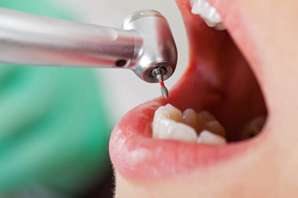 Best Urgent Dental Care for Toothaches in Assumption, IL